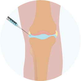 幹細胞抽出・培養