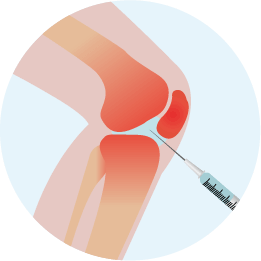 ひざへ注入