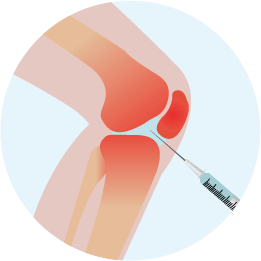 ひざへ注入